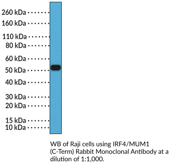Anti-IRF4/MUM1 (C-Term) Rabbit Monoclonal Antibody (Clone RM352)