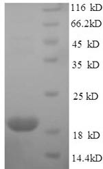 Major urinary protein 2 (Mup2), mouse, recombinant