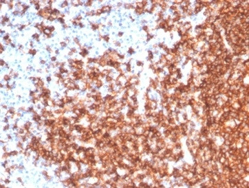 Anti-CD20 / MS4A1 (B-Cell Marker), recombinant antibody, clone MS4A1/7015R