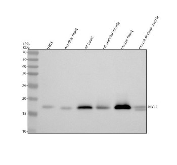 Anti-MYL2 / Myosin regulatory light chain 2