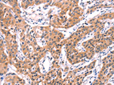 Anti-SERPINA5