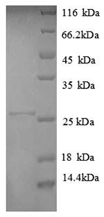 HLA class II histocompatibility antigen, DP alpha 1 chain (HLA-DPA1),partial, human, recombinant
