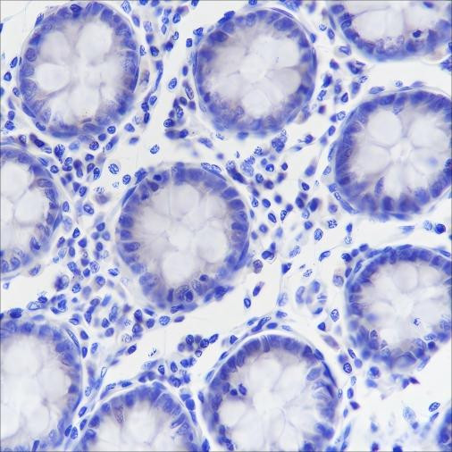 Anti-Recombinant Napsin A, clone A312