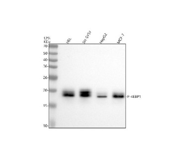 Anti-phospho-eIF4EBP1 (Thr46) / Eukaryotic translation initiation factor 4E binding protein 1, clone