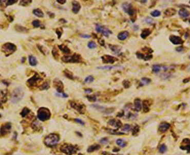 Anti-PSMA1