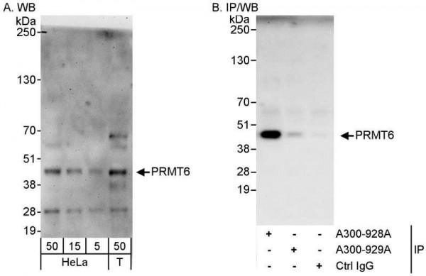 Anti-PRMT6