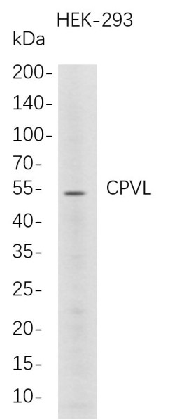 Anti-Recombinant CPVL, clone 5D10