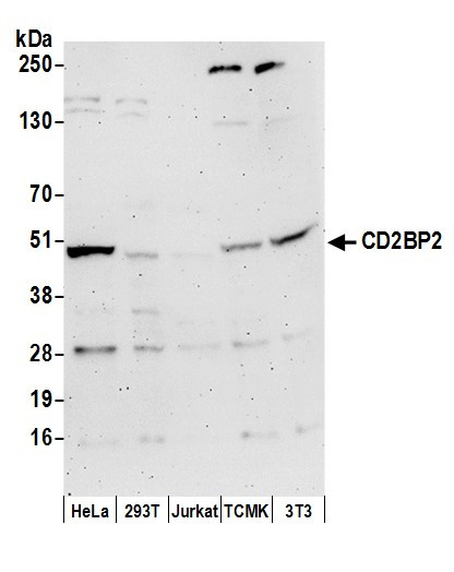 Anti-CD2BP2