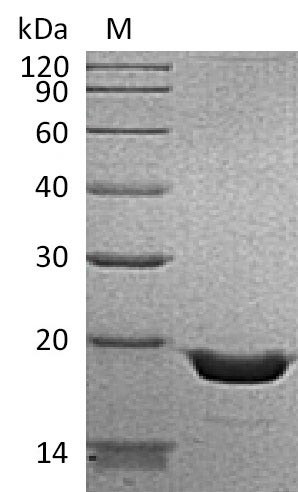 Tumor necrosis factor (TNF), partial (Active), human, recombinant