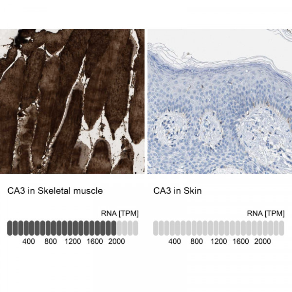 Anti-CA3