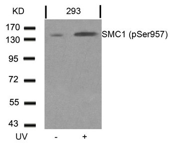 Anti-Phospho-SMC1A (Ser957)