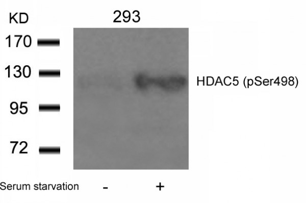 Anti-phospho-HDAC5 (Ser498)