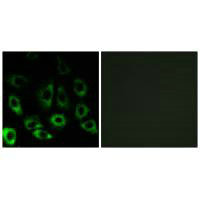 Anti-MBTPS2
