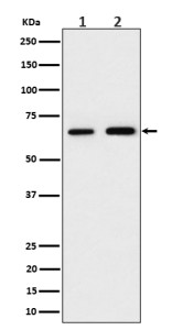 Anti-PGM1 / Phosphoglucomutase 1, clone 30P21