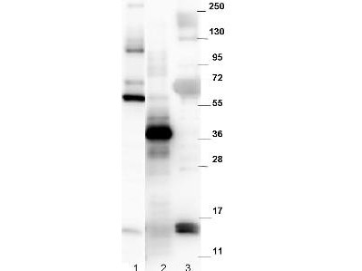 Anti-NAG-1