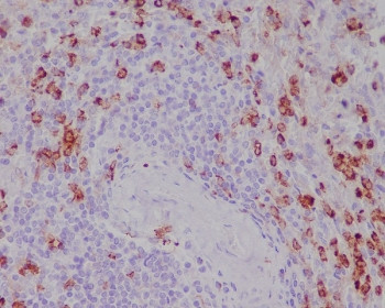 Anti-CD11b / MAC-1, clone GC-9