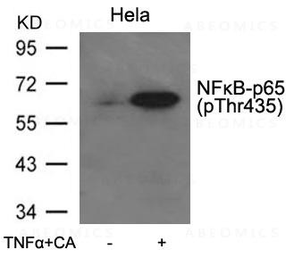 Anti-phospho-NFkB-p65(Thr435)