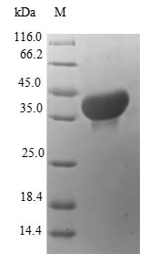Protein S100-A14 (S100A14), human, recombinant