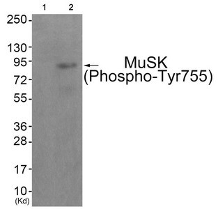 Anti-Phospho-MUSK (Tyr755)