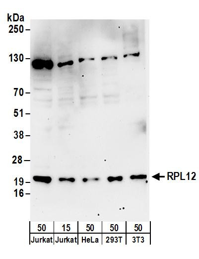 Anti-RPL12