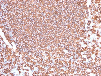 Anti-CD20 / MS4A1, clone IGEL/4524R