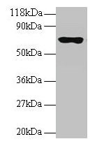 Anti-RPL15