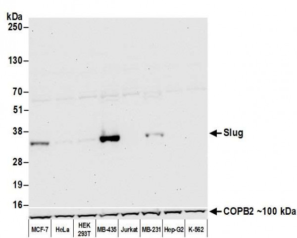 Anti-Slug Recombinant Monoclonal