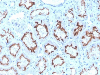 Anti-Interferon gamma / IFNG, clone rIFNG/4467