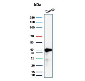 Anti-HLA-E / HLA class I histocompatibility antigen E, clone HLAE/13125