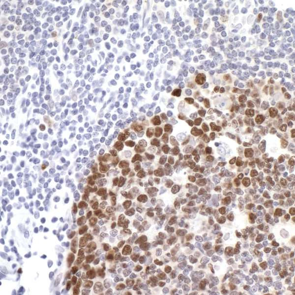 Anti-Ki-67 Recombinant Monoclonal