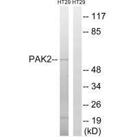 Anti-PAK2 (Ab-197)