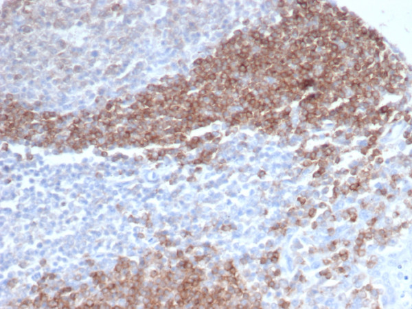 Anti-CD79b (B-Cell Marker), clone CD79b/4960