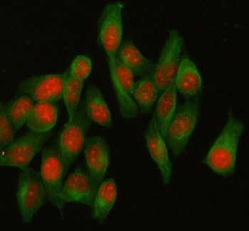 Anti-HELLS / PASG / Lymphoid-specific helicase