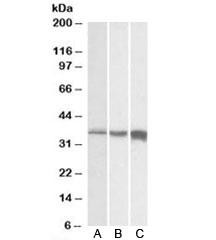 Anti-TNNT3