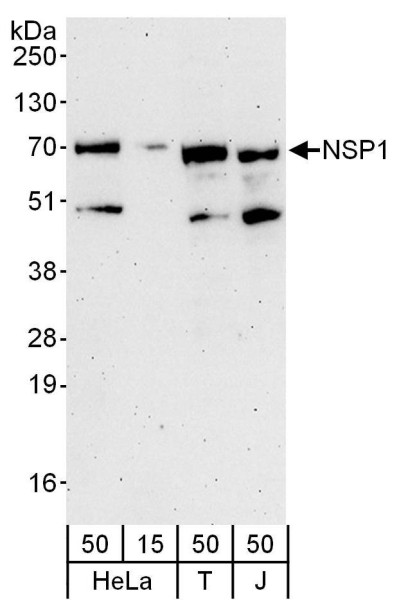 Anti-NSP1