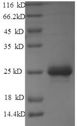 Matrix protein (M), Rabies virus, recombinant