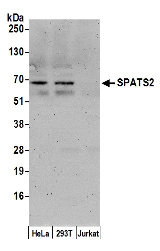 Anti-SPATS2/SPATA10