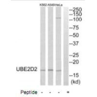 Anti-UBE2D2