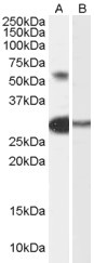 Anti-TCFL5, Internal