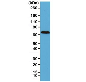 Anti-Neurofilament / NF-L, clone RM280 (recombinant antibody)