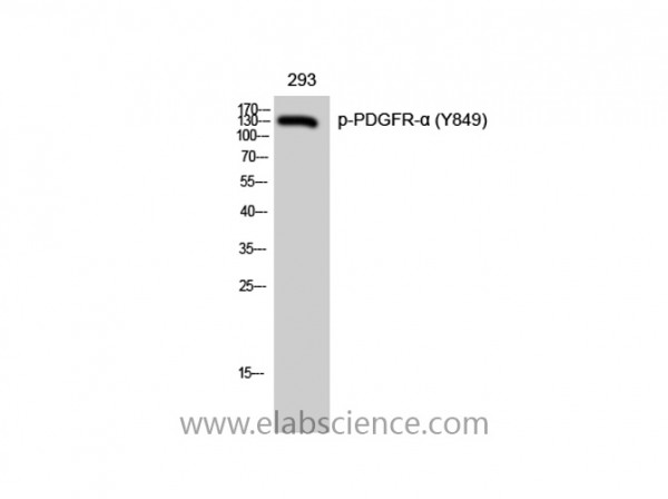 Anti-Phospho-PDGFR-alpha (Tyr849)