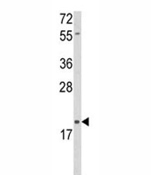 Anti-DLK2