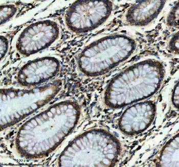 Anti-ITGB7 / Integrin beta 7, clone 32I45