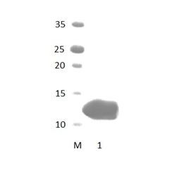 LAP2 PDZ Domain