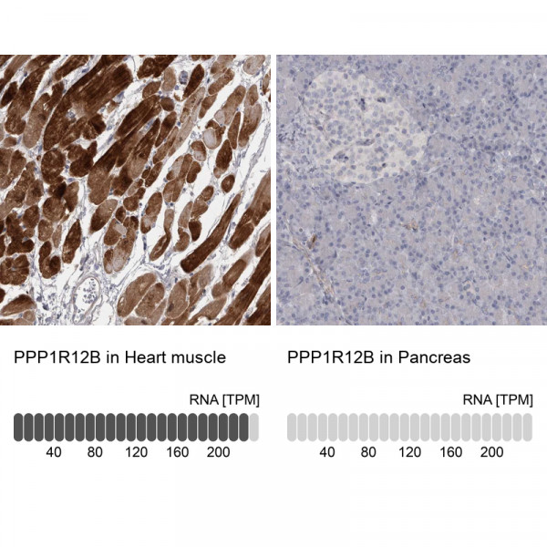 Anti-PPP1R12B