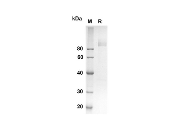 Recombinant Mouse CD36 Protein(Fc Tag)