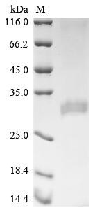 Translationally-controlled tumor proteinv (SMPD1), human, recombinant
