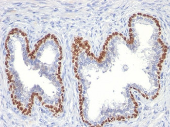 Anti-p63 / Tumor protein 63, clone TP63/11