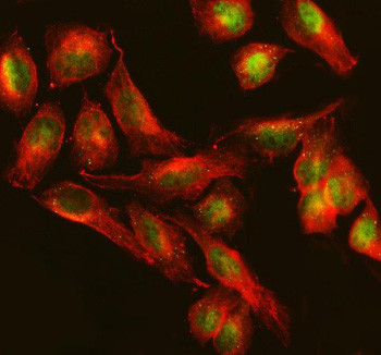 Anti-TTC34 / Tetratricopeptide repeat protein 34