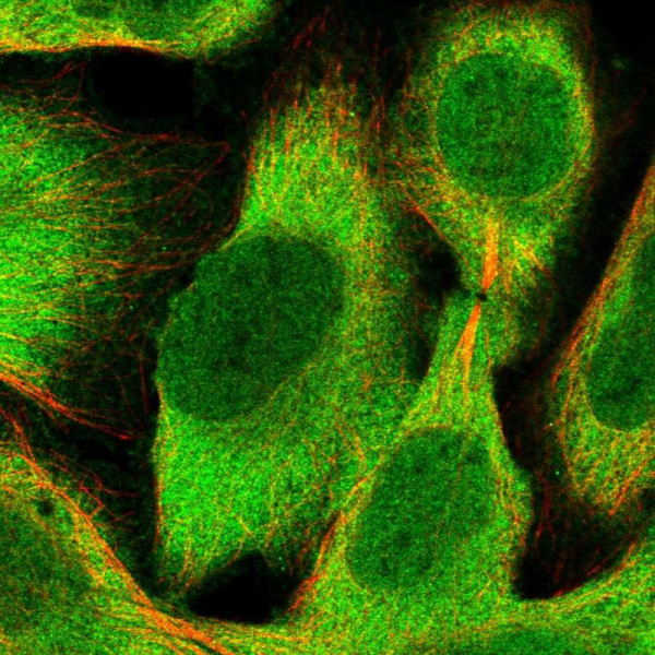 Anti-RNH1
